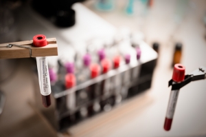 Understanding Full Panel Blood Tests: What They Measure and Why They Matter Understanding Full Panel Blood Tests: What They Measure and Why They Matter